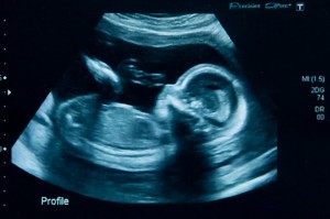 Photo of an ultrasound showing the side-on of a developing baby’s body.